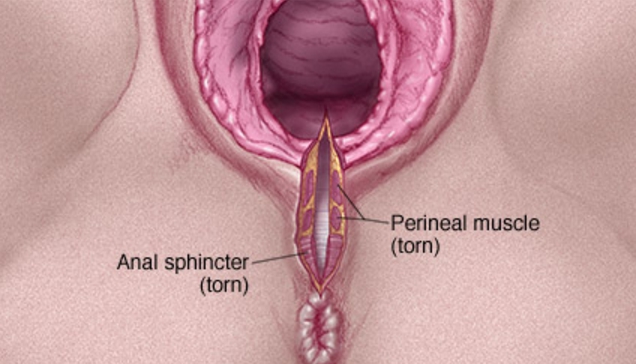 original url: https://s21.postimg.org/bppr9a5tj/screenshot_182.jpg